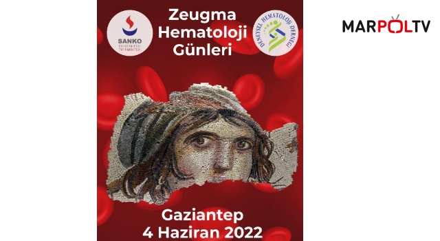 Gaziantep Zeugma Hematoloji Günleri 4 Haziran'da gerçekleştirilecek